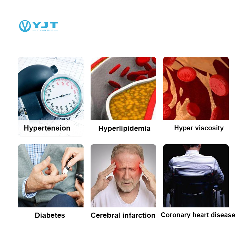 ساعة ذكية YJT OEM ODM موديل 20 - مراجعة Smartwatches وسعره